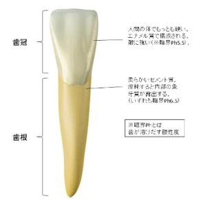 歯根カリエスの図