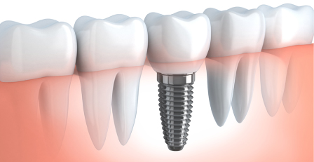 あい歯科クリニック